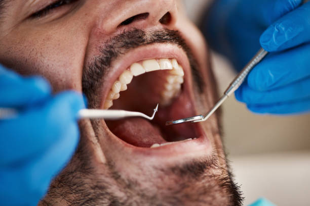 Best Emergency Dentist for Special Needs Patients in Walker Mill, MD