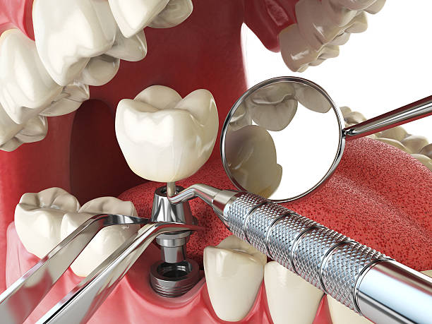 Best Broken or Cracked Tooth Emergency Dentist in Walker Mill, MD